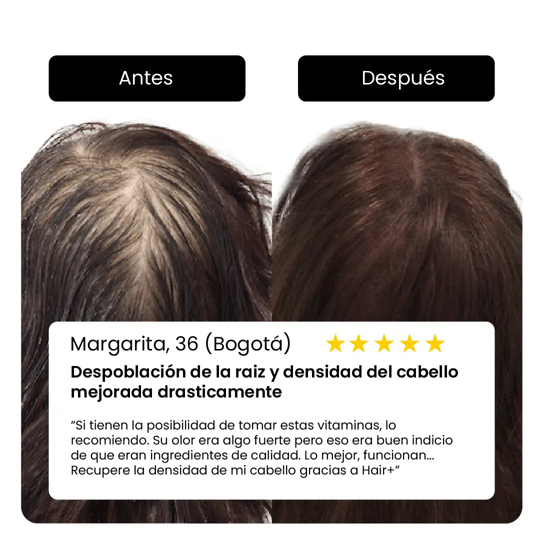 HAIR+ BIGVITA - ORIGINAL